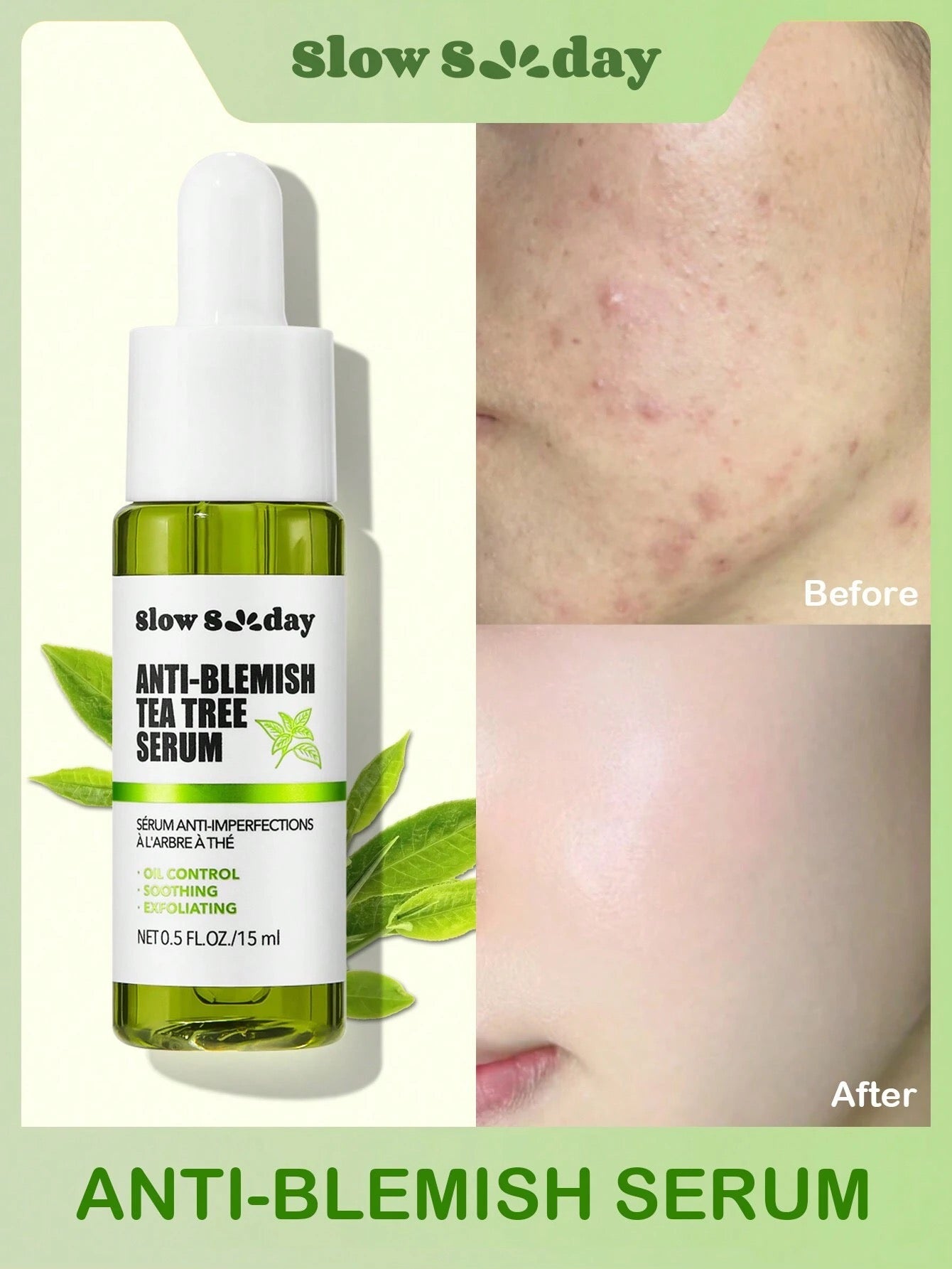 Serum de Árbol de Té -Slowsunday