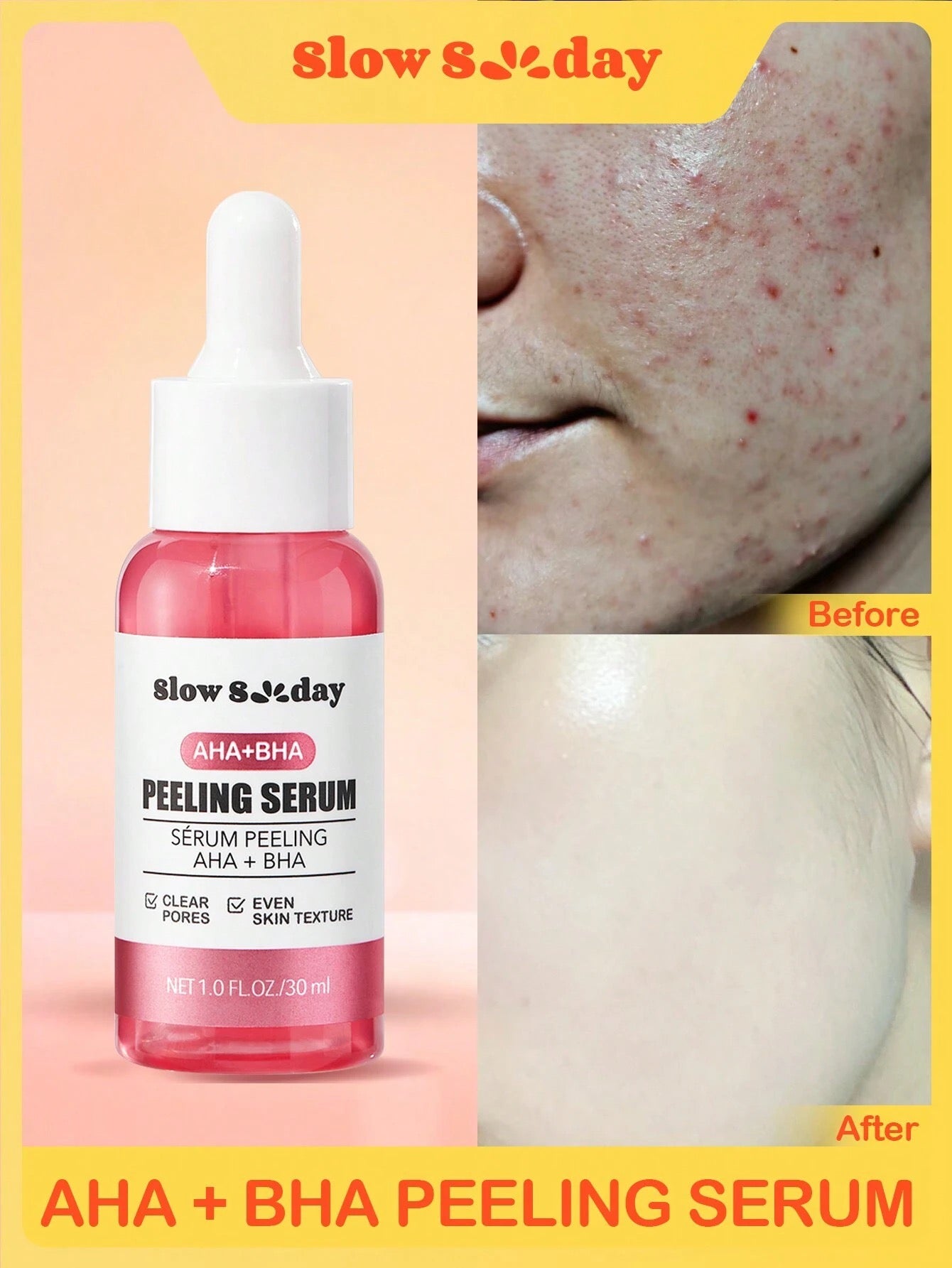 Peeling Serum Slowsunday