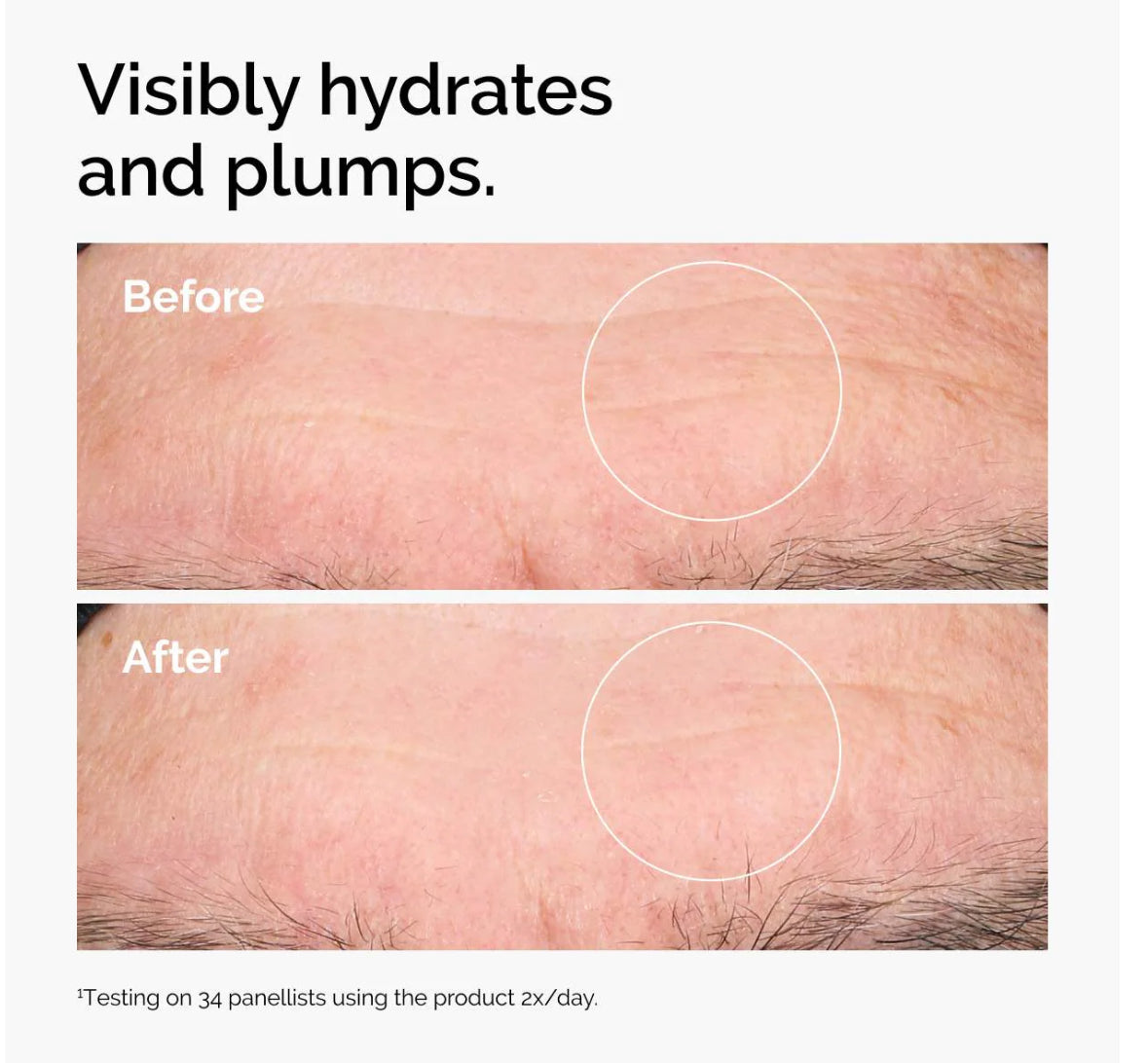 The Ordinary Hyaluronic Acid 2% + B5 / Sérum Ácido Hialurónico 30ml