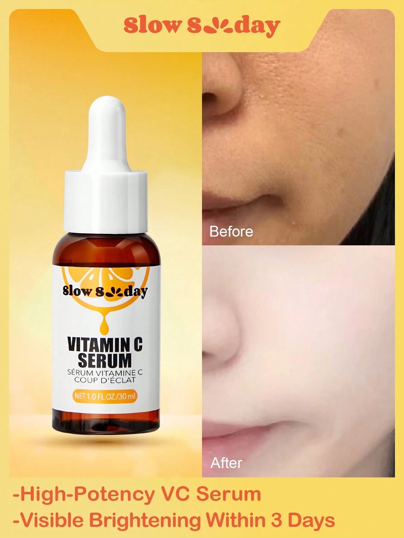 Serum Vitamina C Slowsunday