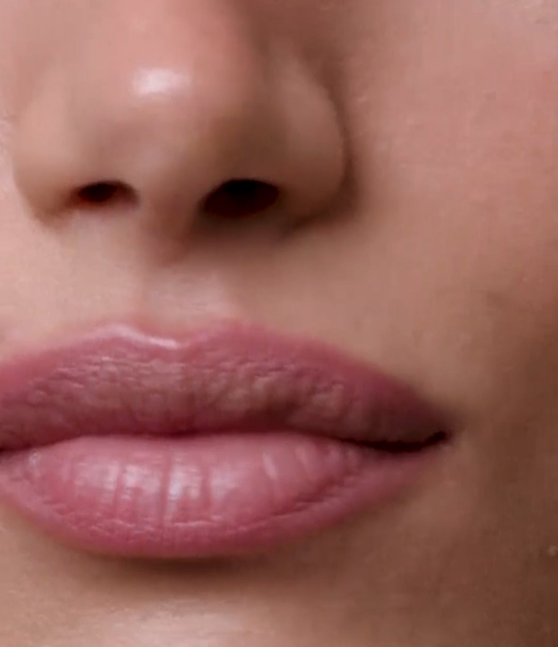 Rhode Peptide Lip Shape
