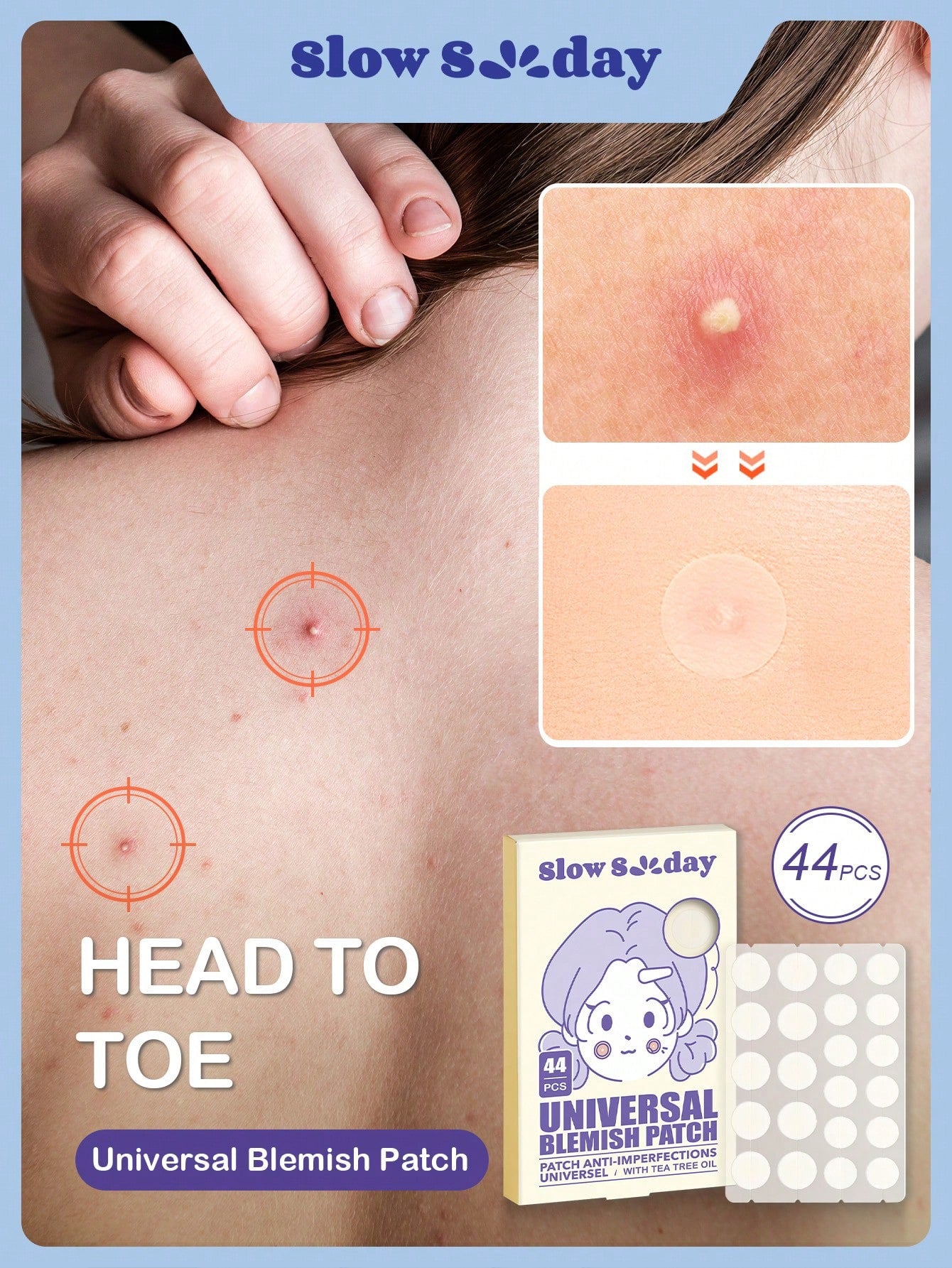 Head to Toe Acne Patches Slowsunday