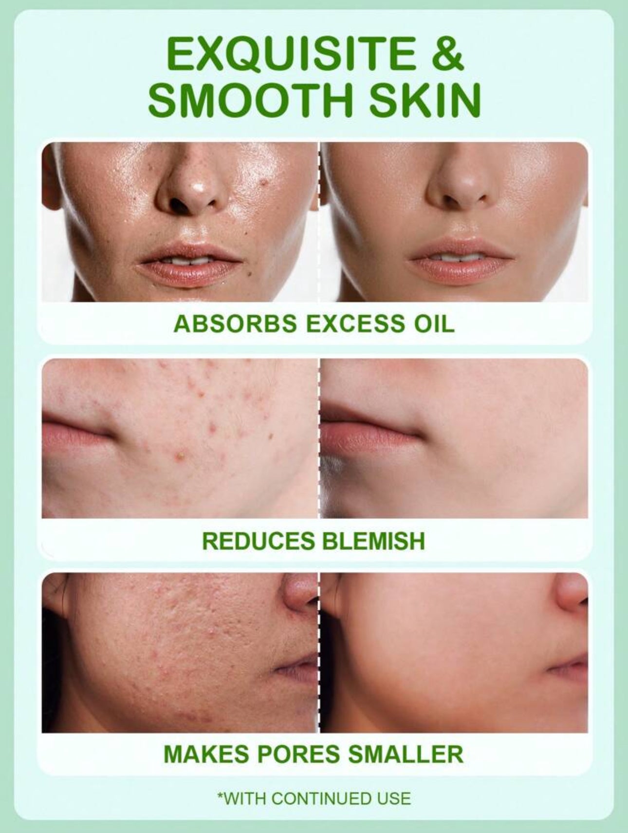 Salicylic Acid Anti-Blemish Gel Slowsunday