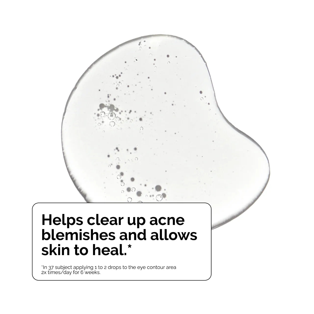 The Ordinary SALICYLIC ACID 2% SOLUTION (SUERO ANTI-IMPERFECCIONES CON ÁCIDO SALICÍLICO)