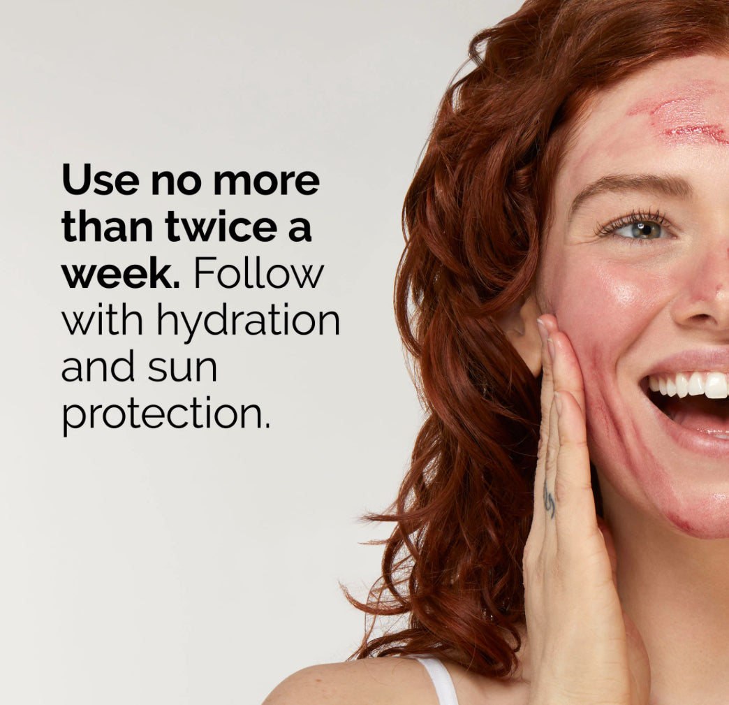 The Ordinary AHA 30% + BHA 2% Peeling Solution / Sérum exfoliante 30ml