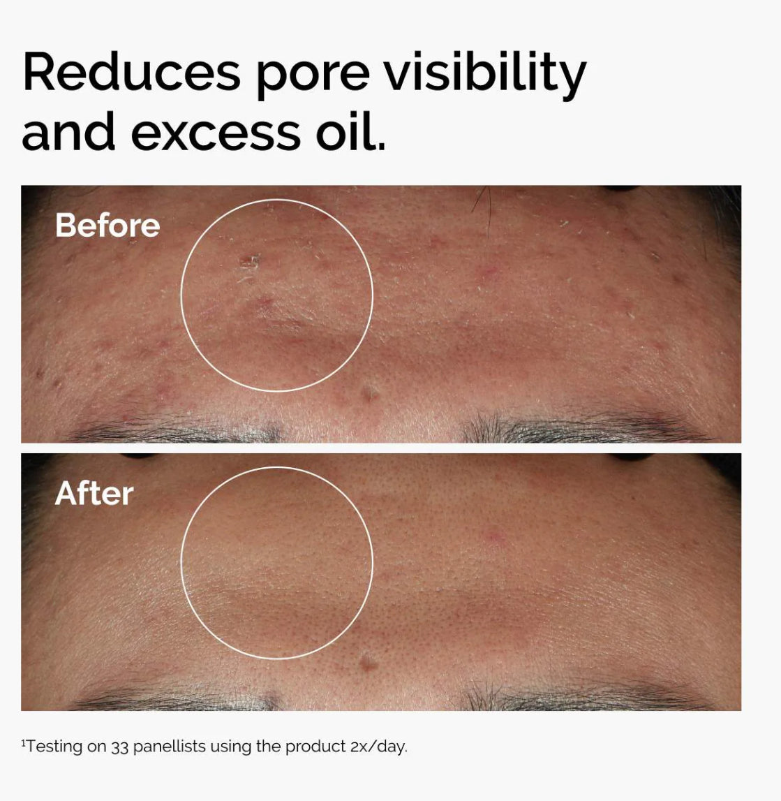 The Ordinary Niacinamide 10% + Zinc 1% / Sérum Vitamina B3 30ml