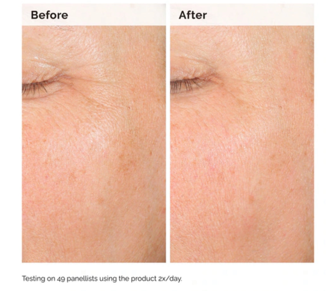 The Ordinary Alpha Arbutin 2% + HA / Sérum Antimanchas 30ml