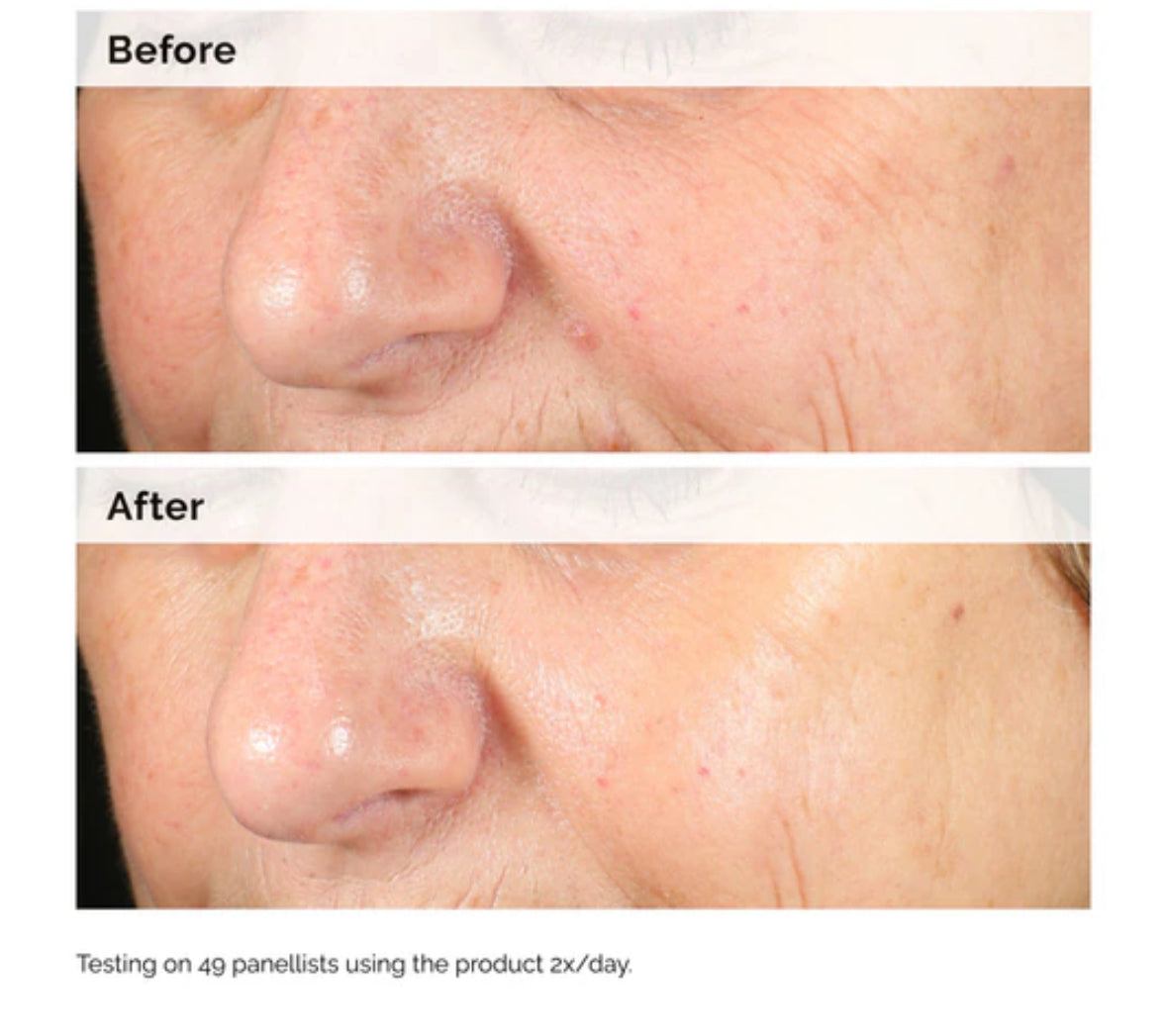 The Ordinary Alpha Arbutin 2% + HA / Sérum Antimanchas 30ml